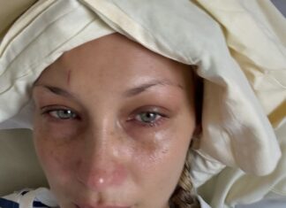 Il ricovero di Bella Hadid preoccupa i fan: “Scusate se sparisco sempre” Bella Hadid Ricovero - Photo Credits Pop Crave