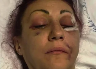 Lucia Regna, il giudice si espone sul marito che le ha spaccato il volto: “Va compreso il contesto, lei ha distrutto un matrimonio”