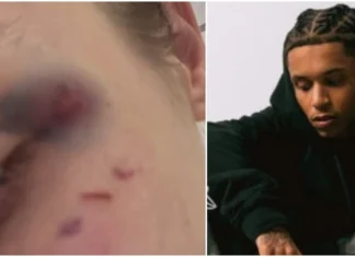 Violenza sulla fidanzata, chi è il rapper Faneto che ha picchiato e minacciato la ragazza
