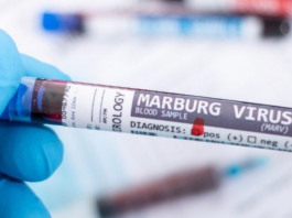 Etiopia, confermati nuovi casi del virus di Marburg