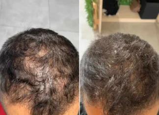 Prendersi cura dei propri capelli: la consulenza personalizzata e il metodo di Natura Tricologica