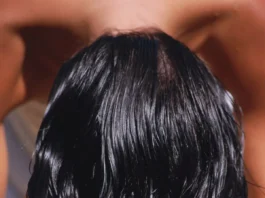 Cinque rimedi semplici ma efficaci per i capelli grassi