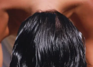 Cinque rimedi semplici ma efficaci per i capelli grassi