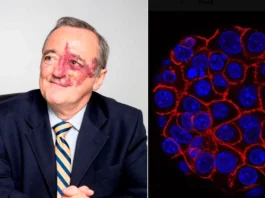 Mariano Barbacid è il ricercatore spagnolo che ha eliminato il tumore al pancreas nei topi