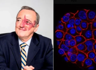Mariano Barbacid è il ricercatore spagnolo che ha eliminato il tumore al pancreas nei topi