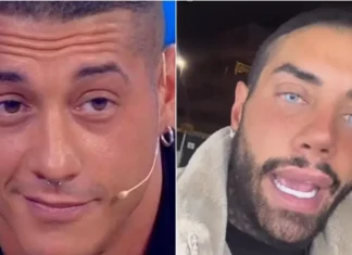 Com’era prima e com’è oggi Francesco Chiofalo, tutti i cambiamenti dopo gli interventi chirurgici