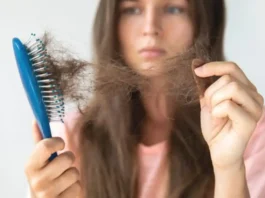 Caduta dei capelli per colpa dello stress? La soluzione c’è ed è… scontata Stress Caduta Capelli - Photo Credits FoodFarma