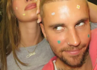 Rhode x Bieber è la collab più random (e geniale) del momento: pimple patch cute + vibe Coachella